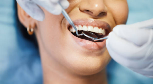Best Dental Abscess Treatment in Troy, MI